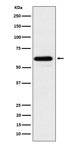 Parafibromin Ab