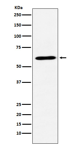 DRP 1 Ab