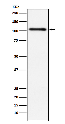 PKD2 Ab