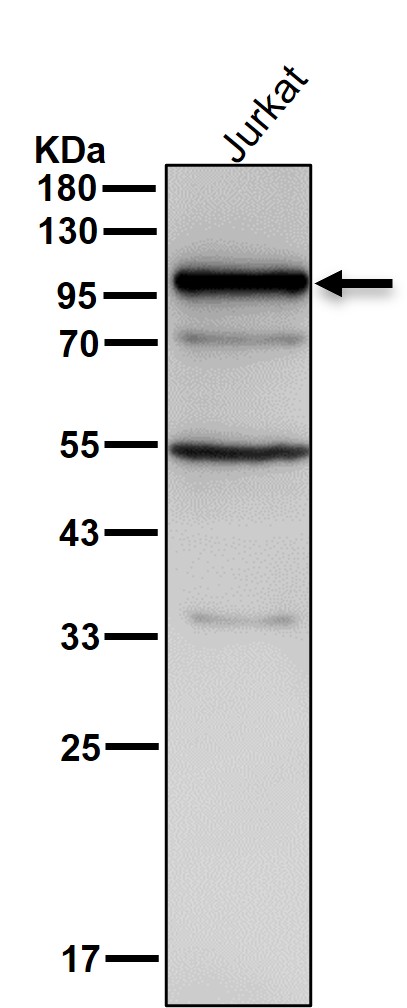 PKD2 Ab