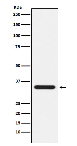 Presenilin 1 Ab