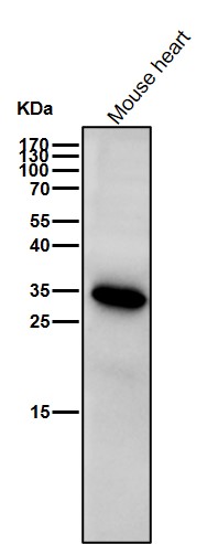 Presenilin 1 Ab