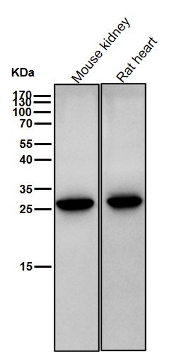 Presenilin 1 Ab