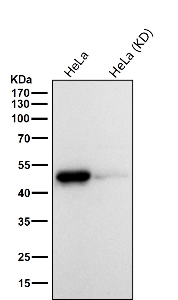 alpha Galactosidase A Ab