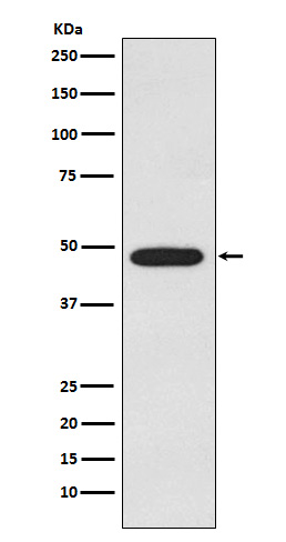 alpha Galactosidase A Ab