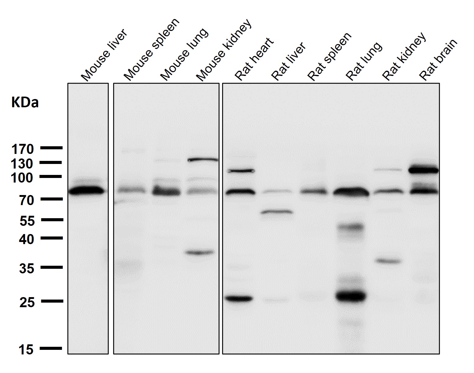 5 Lipoxygenase Ab