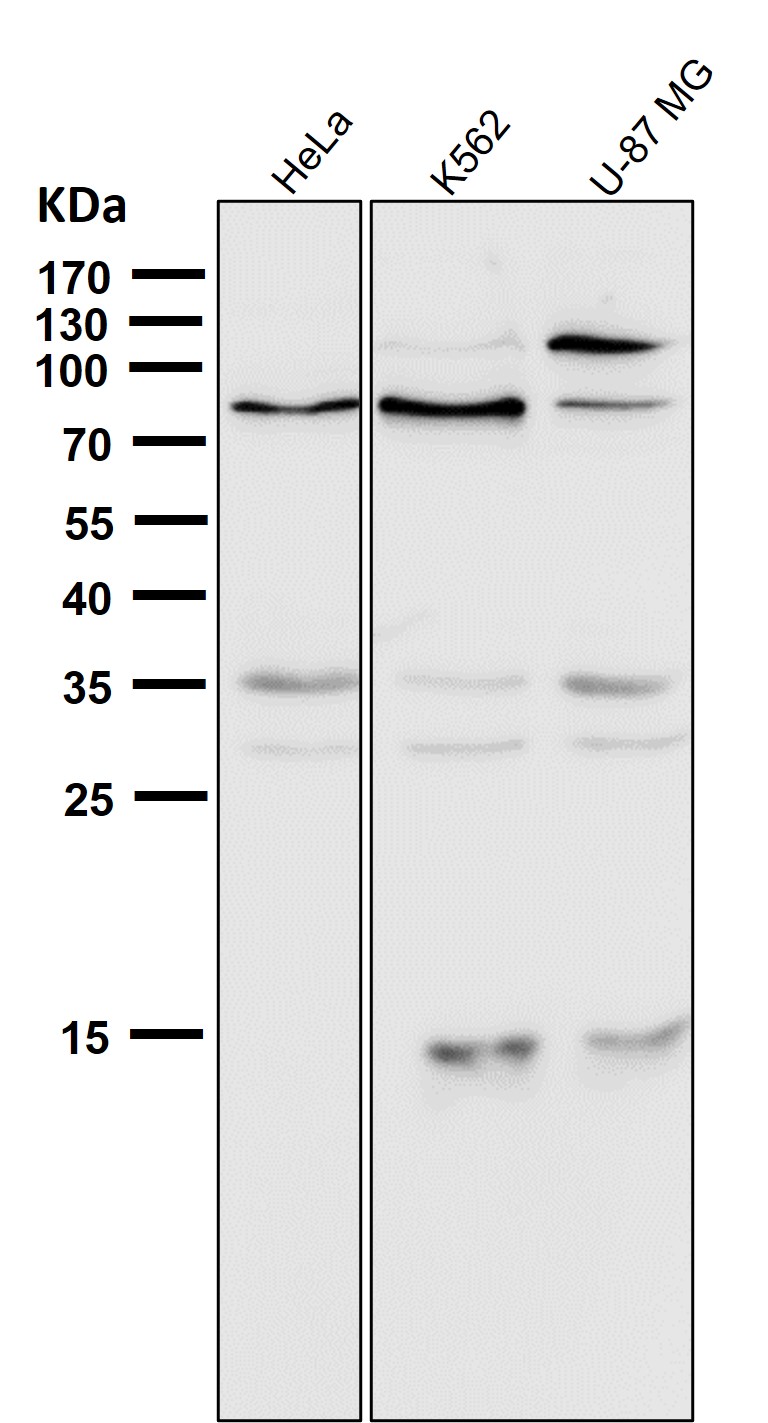 5 Lipoxygenase Ab