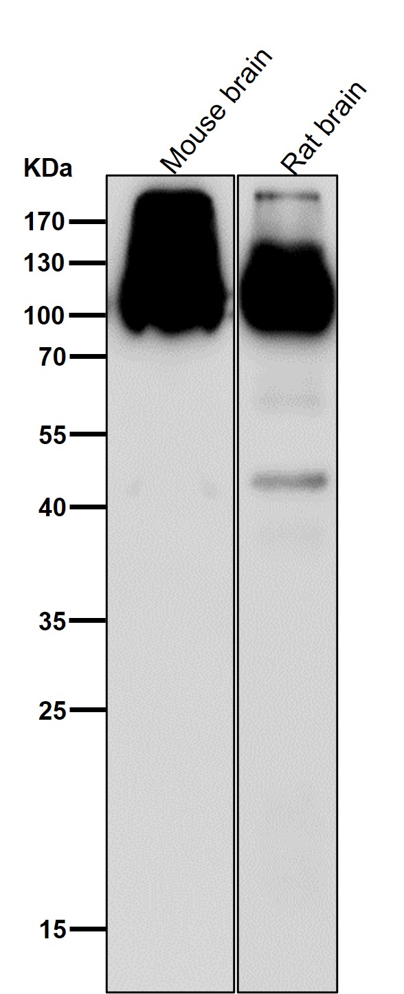 GluR2/3 Ab