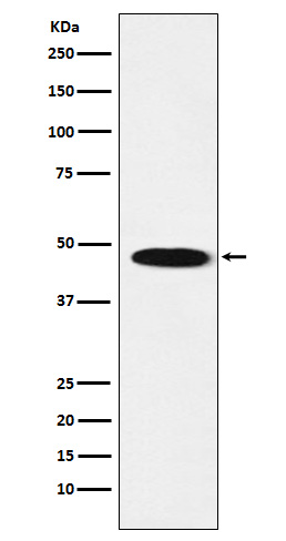 GABRB1 Ab