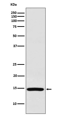 RPS19 Ab