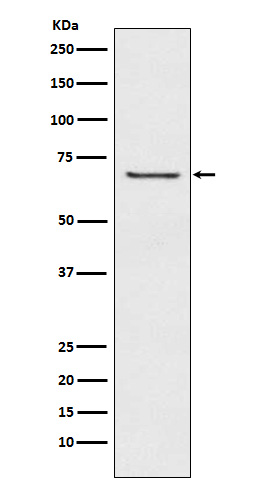 GABRB2 Ab