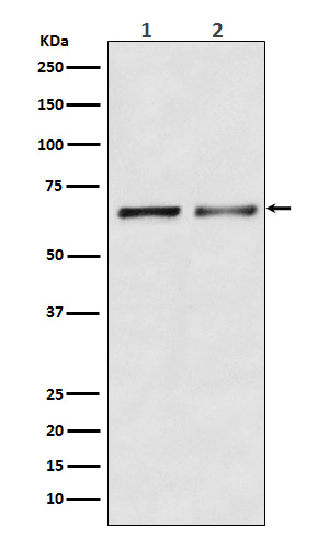 Activin receptor type 2B Ab