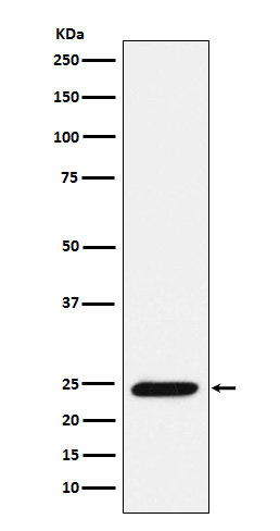 Bcl 2 modifying factor Ab