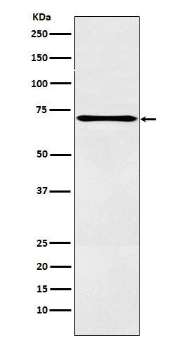 ALOX12 Ab