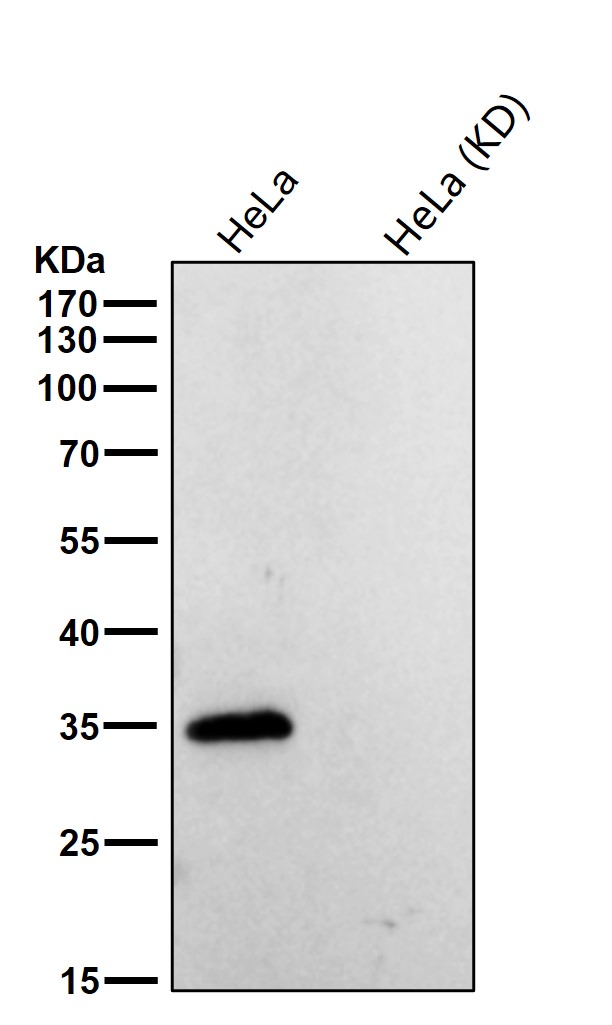 AKR1C1/2 Ab