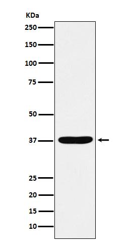 AKR1C1/2 Ab