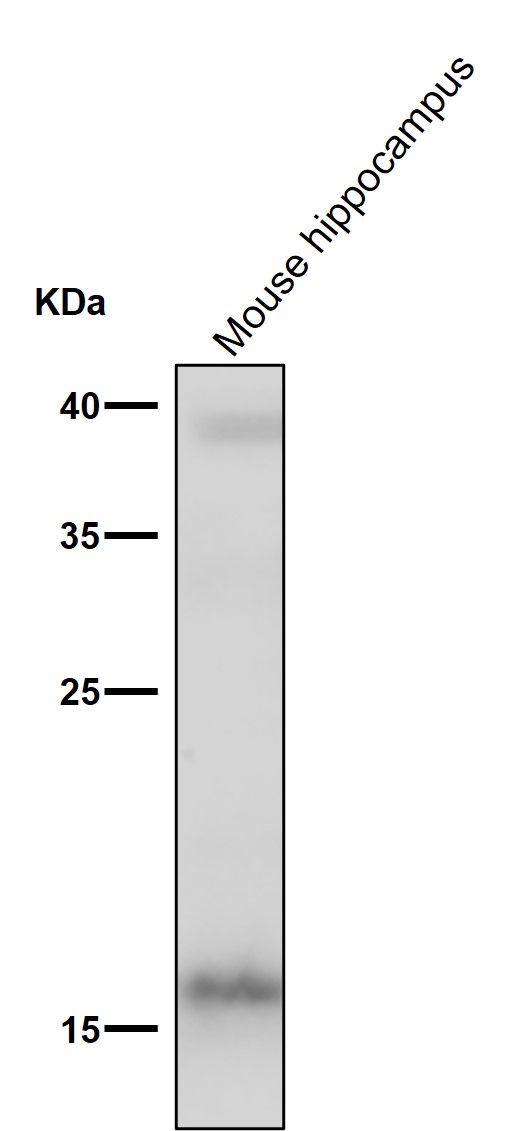 FGF1 Ab