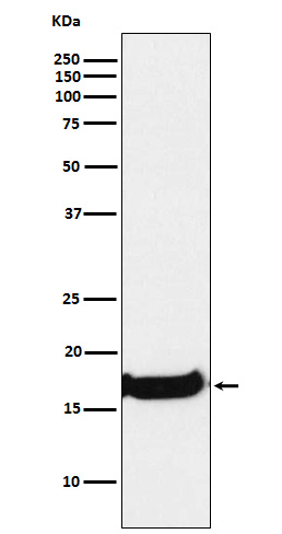 Uteroglobin Ab