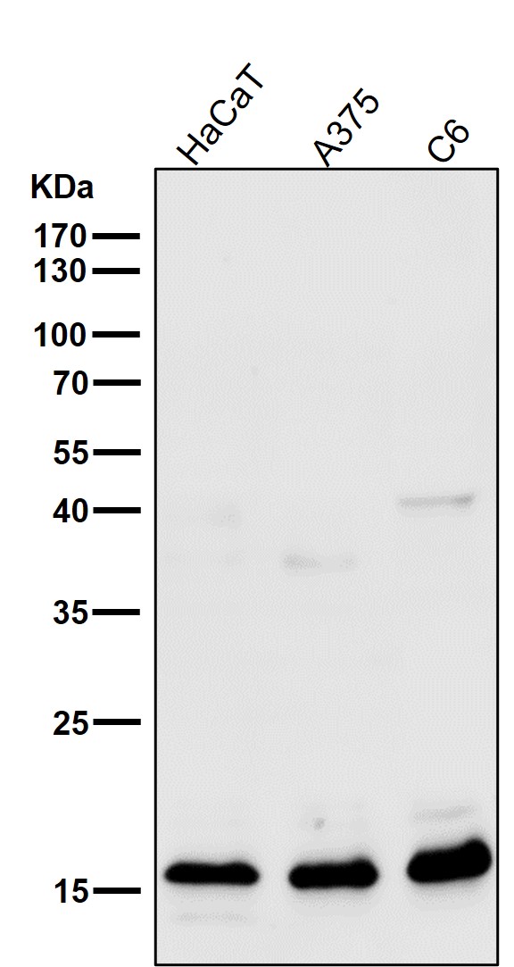 Uteroglobin Ab