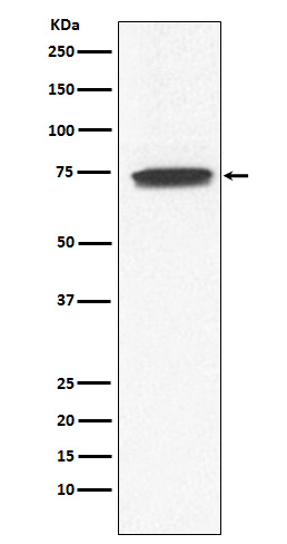 GCS alpha 1 Ab