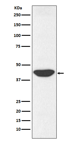 IDH1 Ab