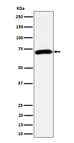 Choline O cetyltransferase Ab