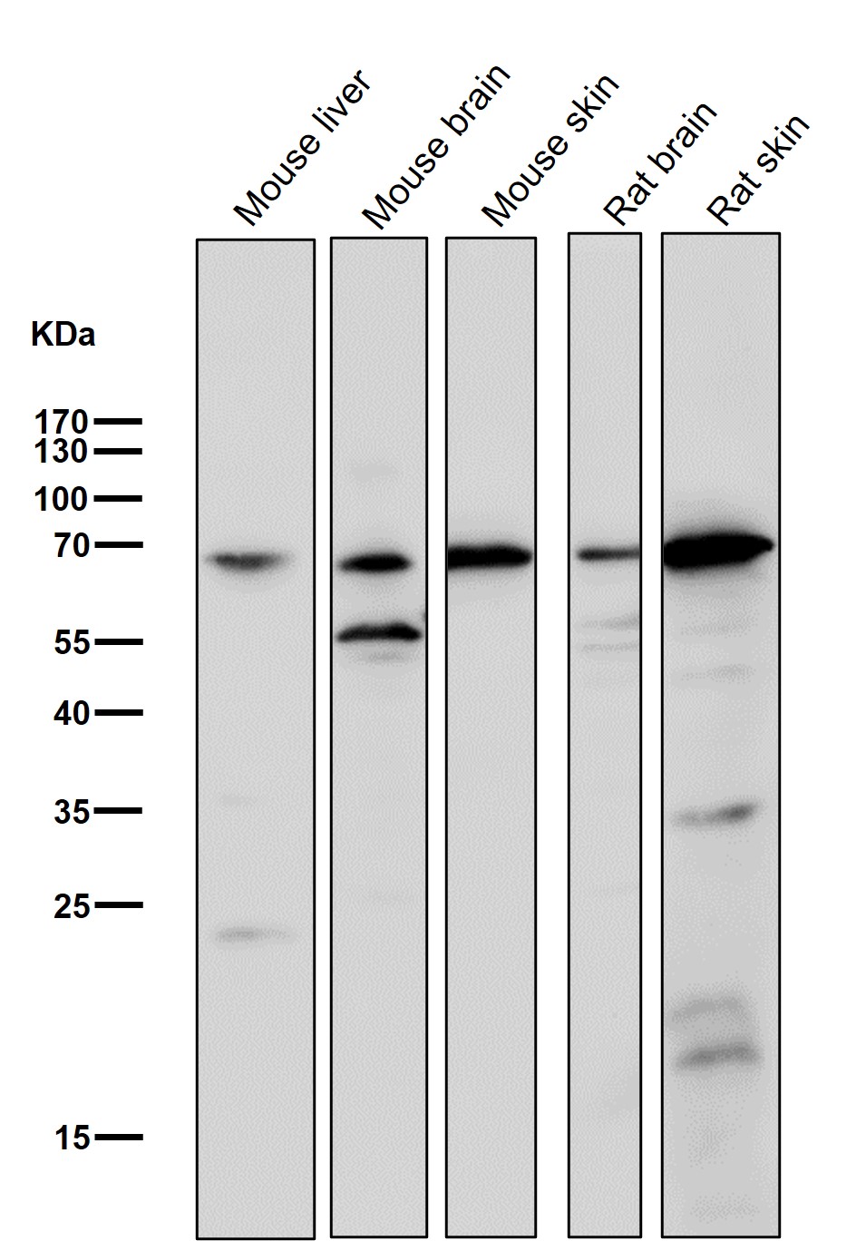 Choline O cetyltransferase Ab