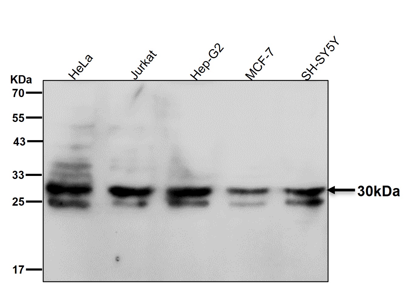 Histone H1.2 Ab