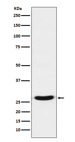 TCF21 Ab