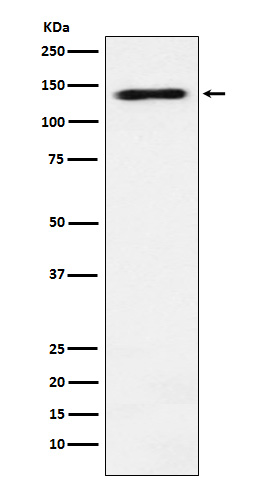 ATP dependent RNA helicase A Ab