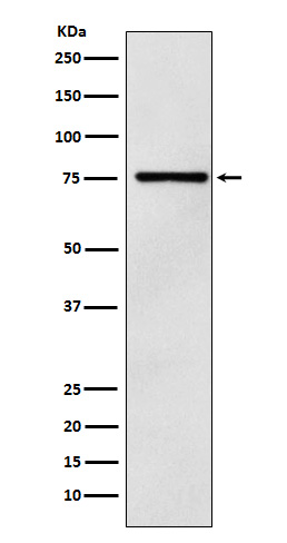 DCP1A Ab