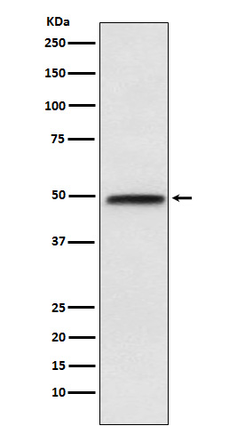 NFIB type Ab