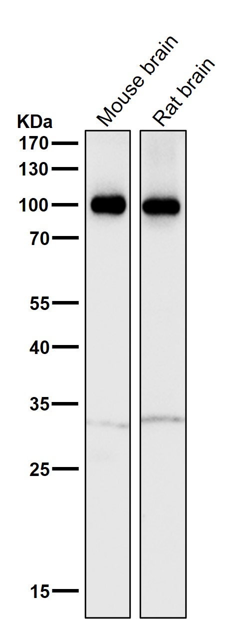 ATP1A3 Ab