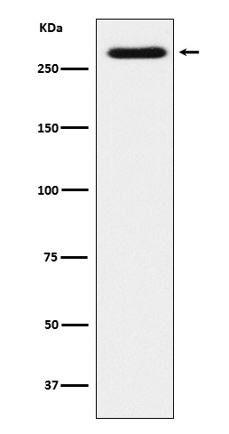 Sortilin related receptor Ab