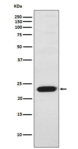 TNNI2 Ab