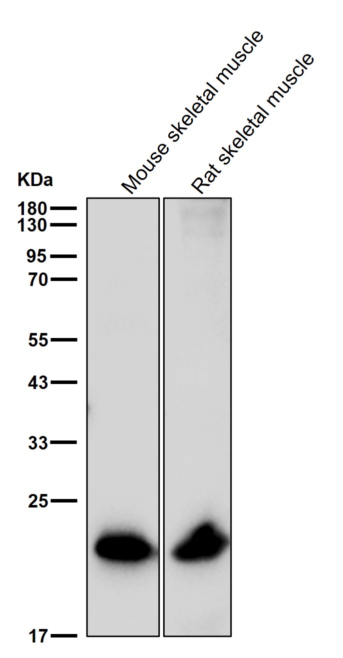 TNNI2 Ab