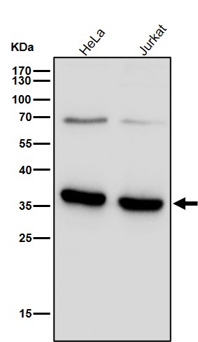 TREX1 Ab