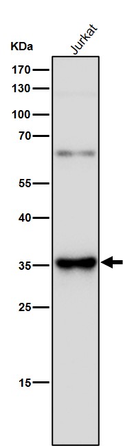 TREX1 Ab