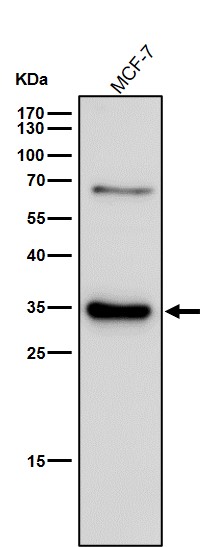 TREX1 Ab