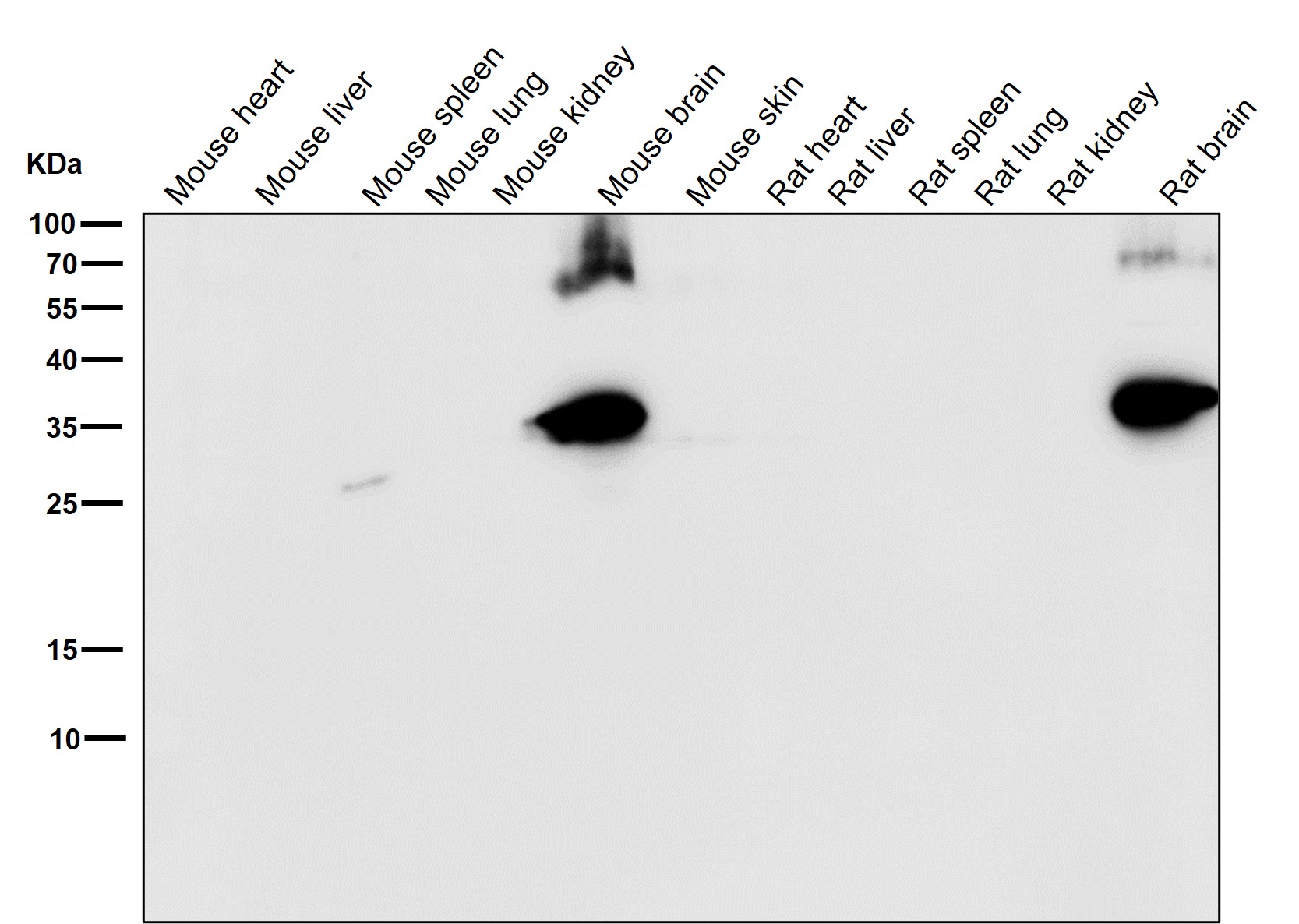 Syntaxin 1B Ab