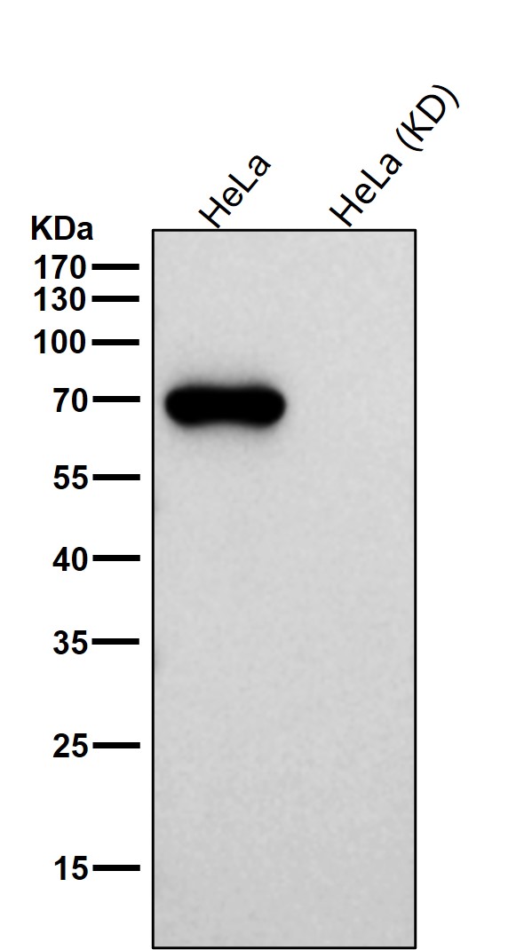 Alkaline phosphatase Ab