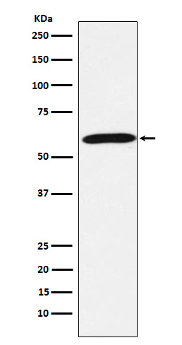 Calsequestrin 1 Ab