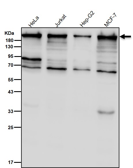 PRPF8 Ab