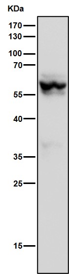 Nuclear receptor ROR beta Ab