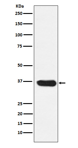 LDHA Ab