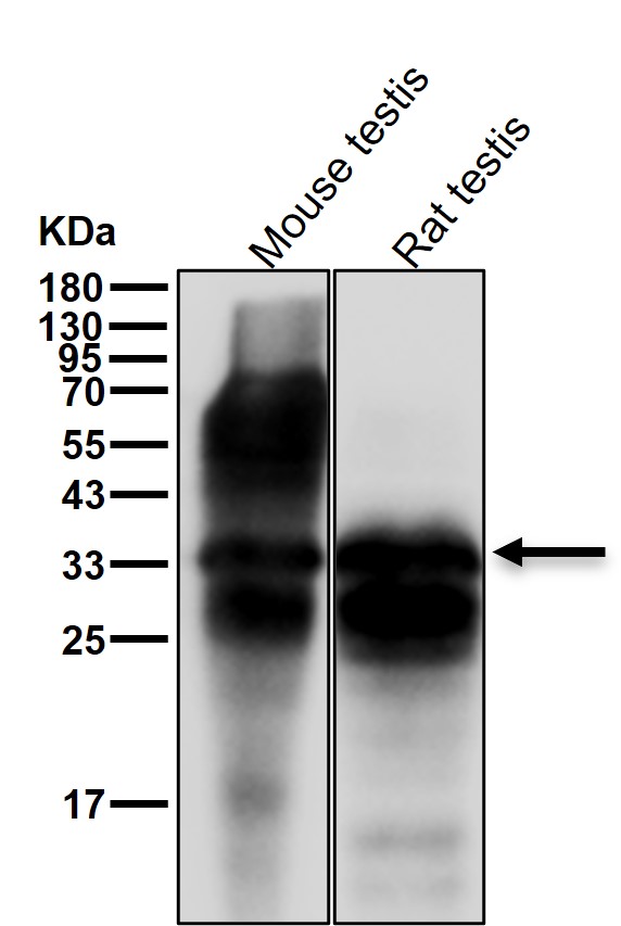 ACRV1 Ab