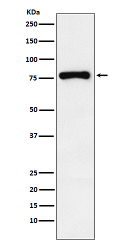 RNase L Ab