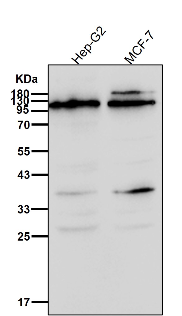 CENPC Ab