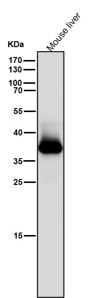 AKR1C3 Ab