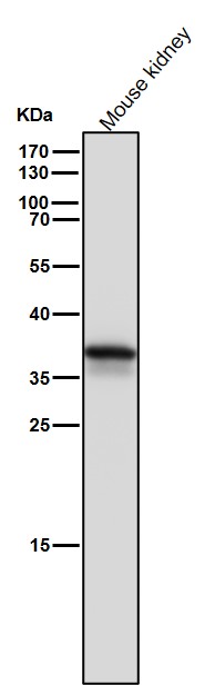 AKR1C3 Ab